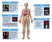 Cardiooncology-6