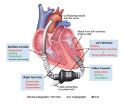 JACC-Case-Reports-Vergaro-CI-September-2020-V5