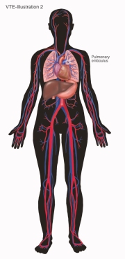 Saatchi-VTE-Illustration-2