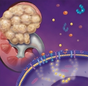 Kidney Carcinoma