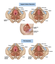 AUGS-Gynecology-5