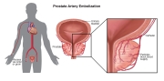 Interventional-Radiology-2