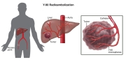 Interventional-Radiology-3