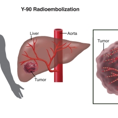 Interventional-Radiology-3