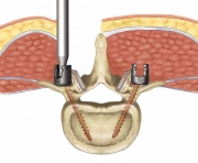 Orthopedic Surgery-2