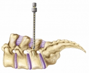 Orthopedic Surgery