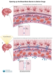 Neuro-2